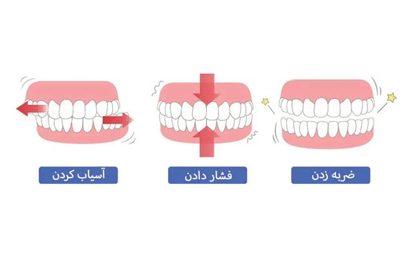 علل دندان قروچه در خواب